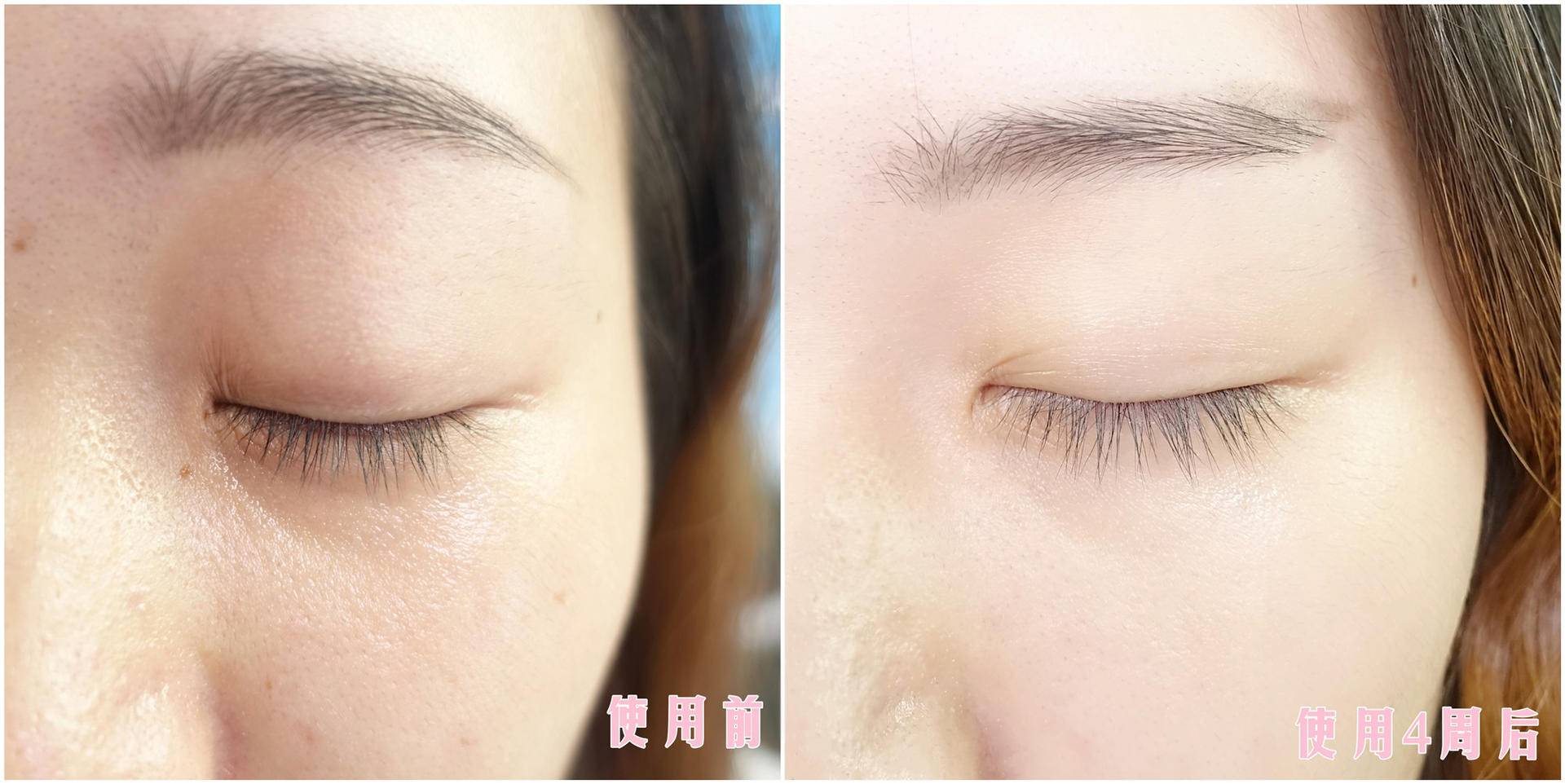 olay小白瓶去唇周黑,olay小白瓶亲测