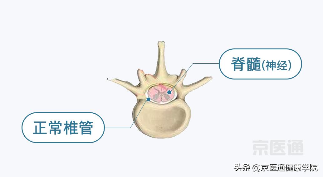 腰痛骨科怎么治疗,腰痛腿痛有什么特效药