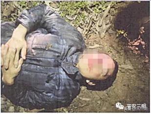 骑车把颈椎撞折了,男子摔断颈椎