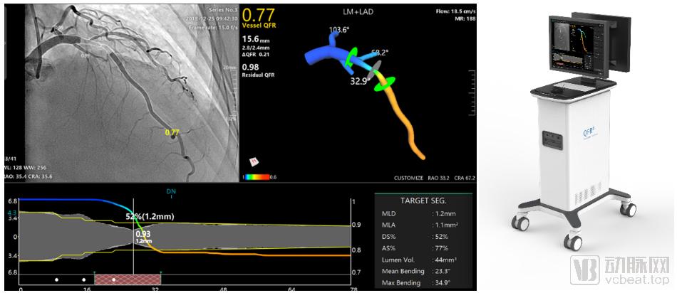 全球首款ai药物完成2期临床试验,ai-qfr冠脉精准诊断系统全球首发