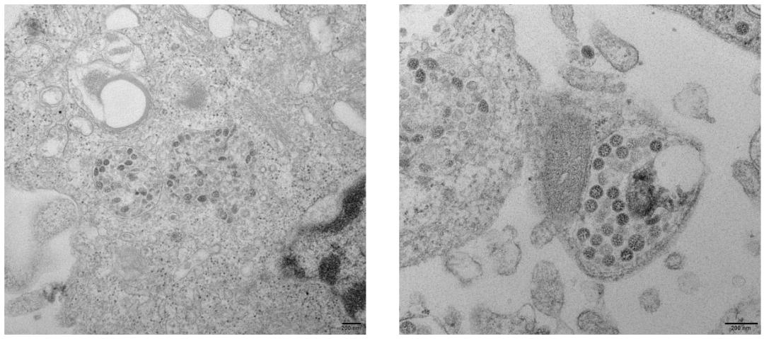 中医科学院任丽丽,任丽丽