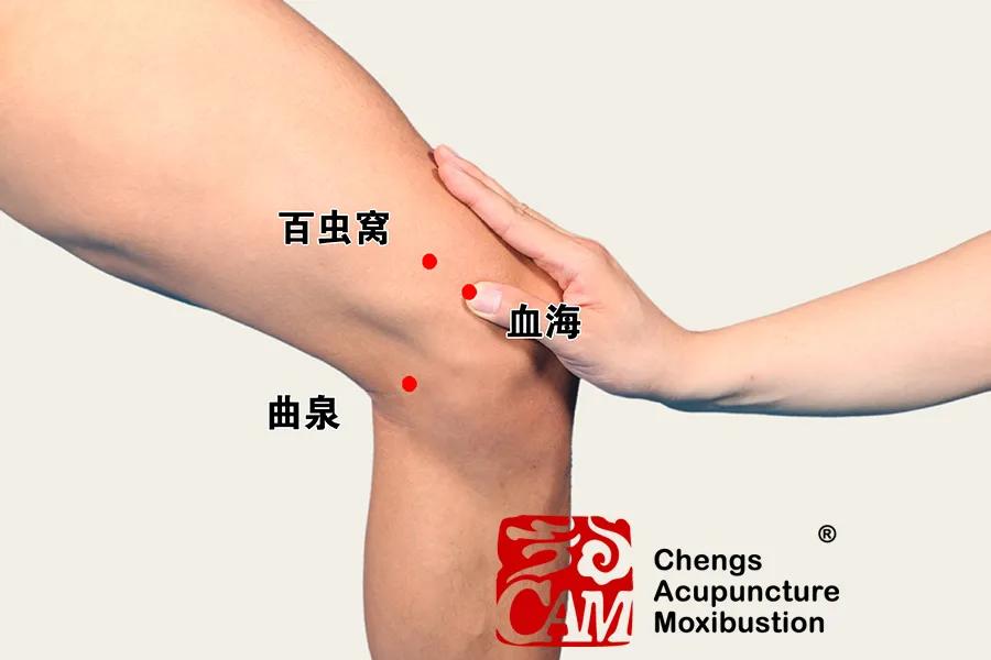 麻疹痒抹什么药止痒效果好,发热引起的荨麻疹夜晚止痒妙招