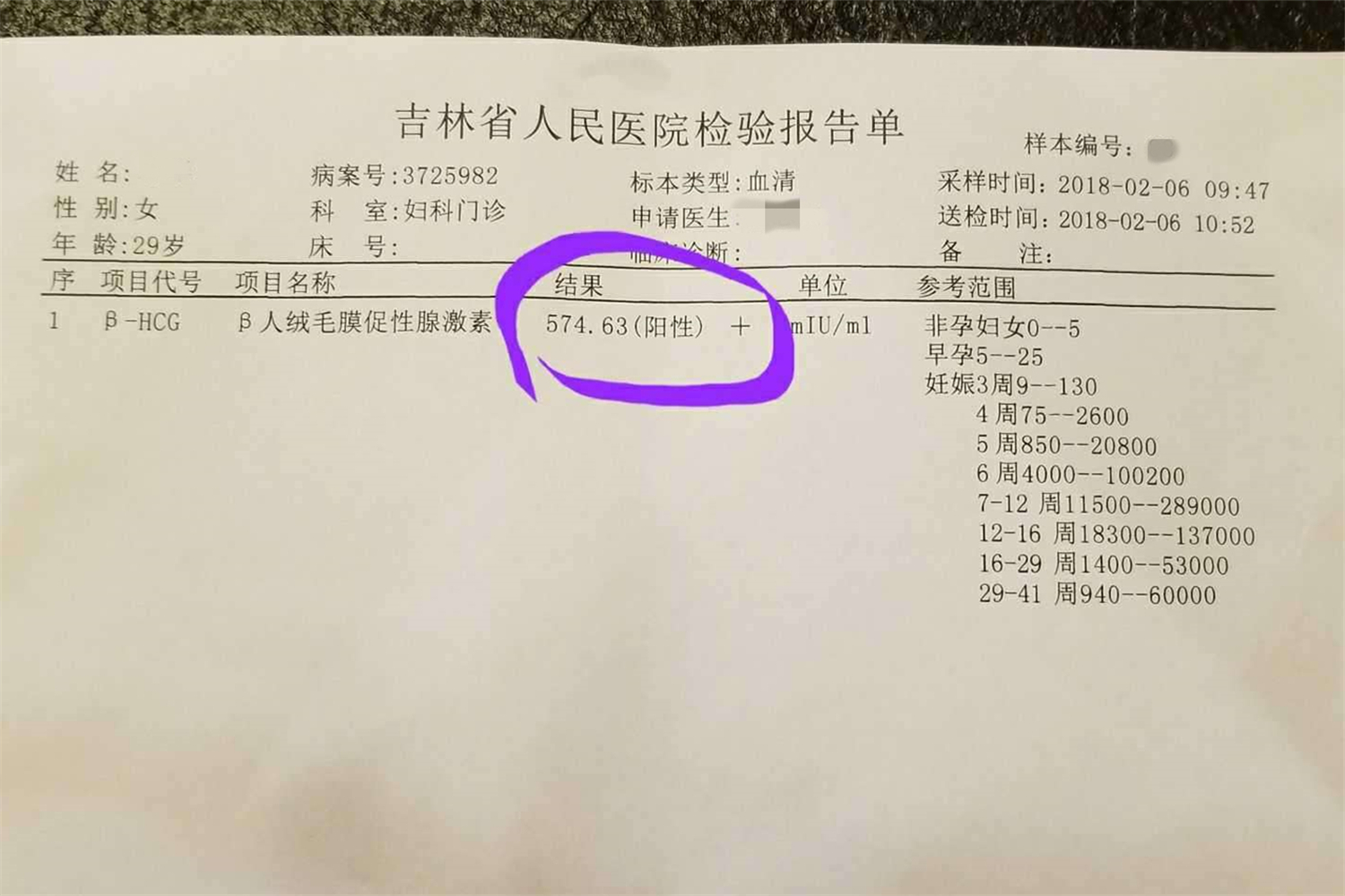 怀孕后最快多久可以知道,怀孕多长时间能知道有什么症状