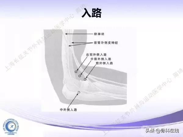 肘关节镜手术后引流,肘关节镜微创手术