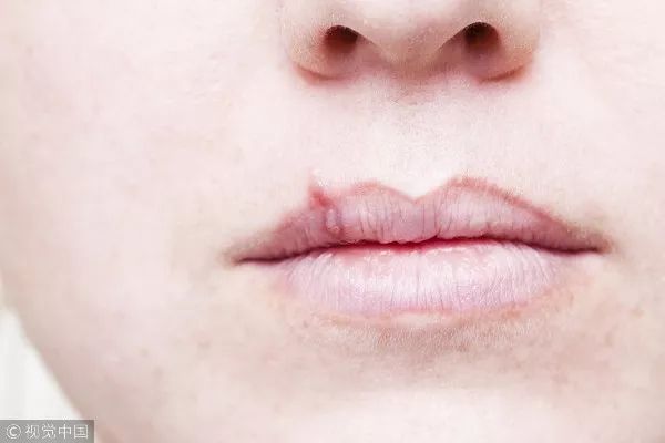 别小瞧几块钱一瓶的维生素b2,维生素b2几块钱一瓶有效果