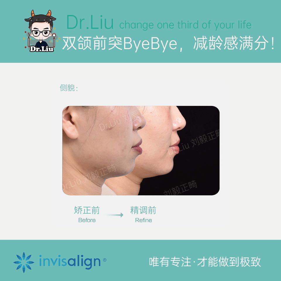 鍘﹂棬鐗欓娇缇庡,鍘﹂棬鐗欓娇鐭闅愬舰姝g暩