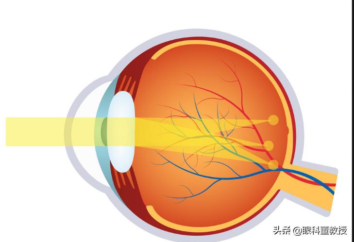 晶体脱落可以用什么药,换晶体后晶体脱落怎么办