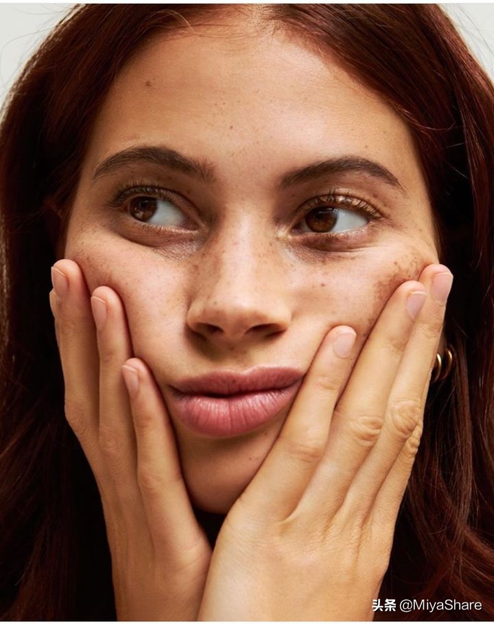 油皮水乳套装推荐收缩毛孔祛闭口,混油皮毛孔粗大有闭口怎么改善