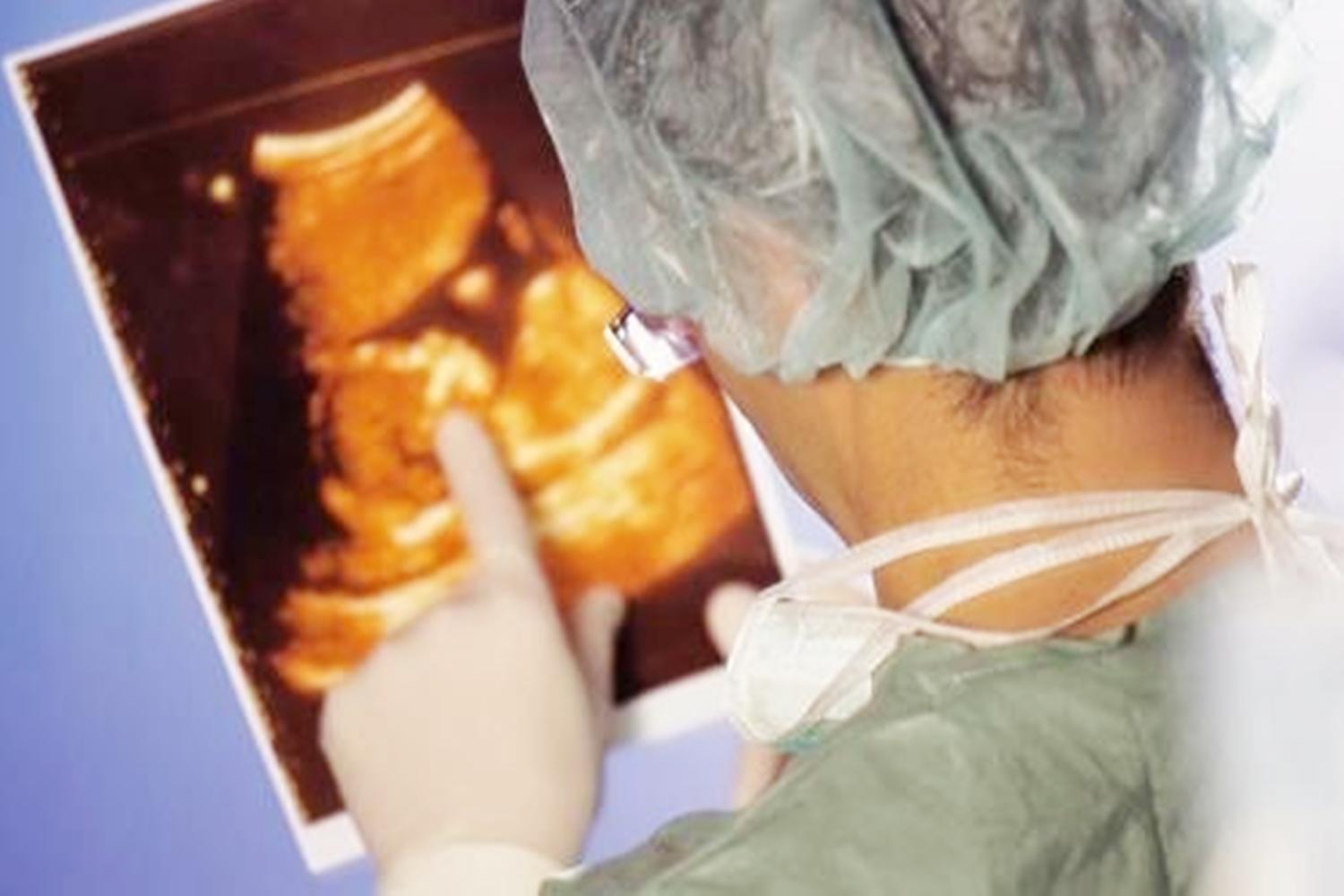 孕早期做b超怎么判断宝宝健康,早孕b超怎么看出胎儿的信息