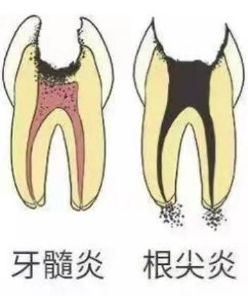 孩子不配合治牙如何引导,儿童拒绝治牙怎么办