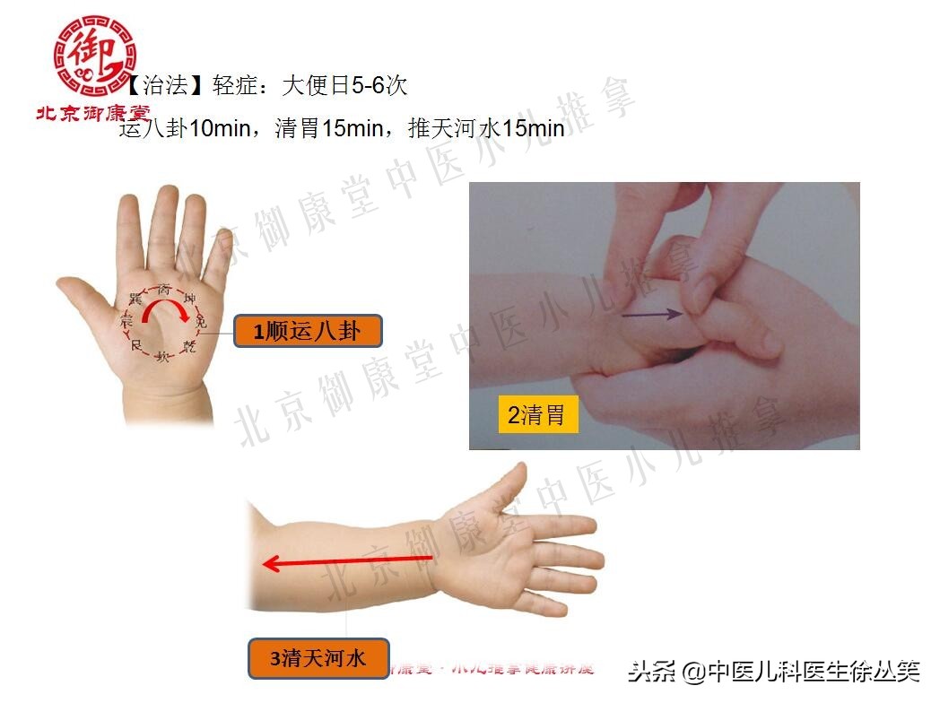 孩子拉肚子伴有发烧怎么推拿,小孩腹泻高烧是什么原因