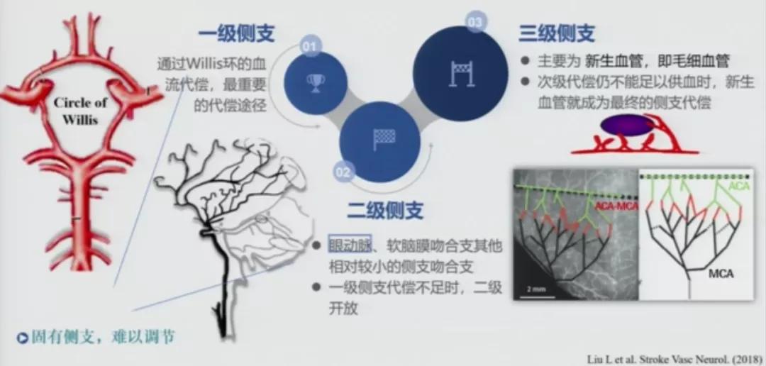 急性脑中风影像诊断选择,急性脑卒中首选哪种检查方法