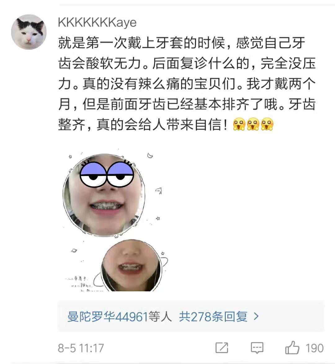 戴牙套是什么感受,戴牙套是什么体验的视频