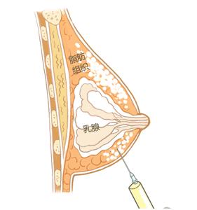 女朋友的胸，为什么忽大忽小？