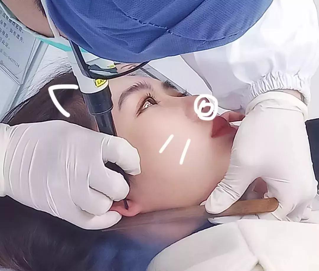 打三个耳洞有什么忌讳,三种人要打耳洞