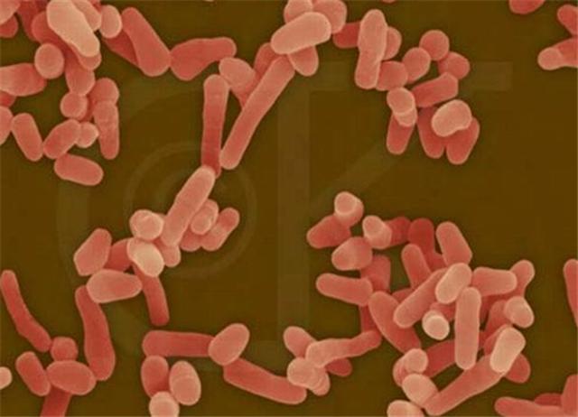 肺结核合并肺癌可以化疗吗,肺结核治疗需要化疗吗