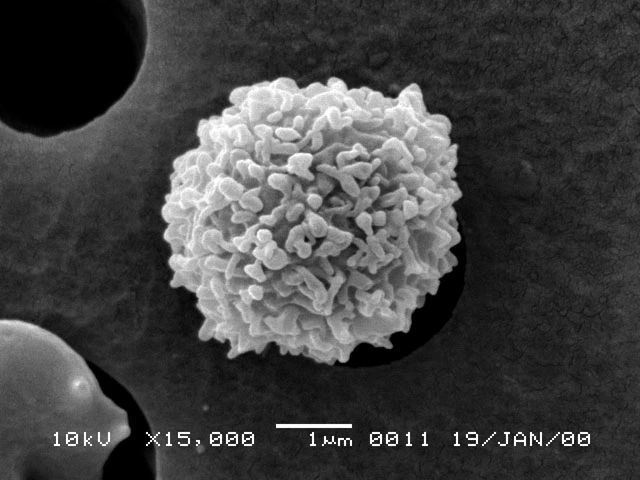 83天痛不欲生的活体腐烂，他在一次核事故后缓慢死去