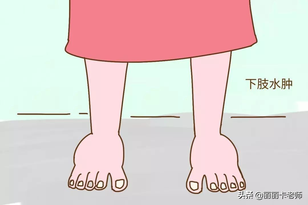 宫颈癌放化疗后腿肿怎么解决,宫颈癌放化疗后为什么大腿会肿