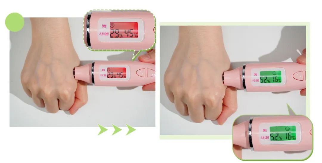 皮肤怎么变得白白嫩嫩干干净净,怎么让自己变得白白嫩嫩