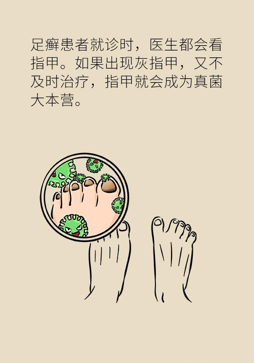 脚气脚痒烂脚丫怎么根治,脚气脚痒老方法