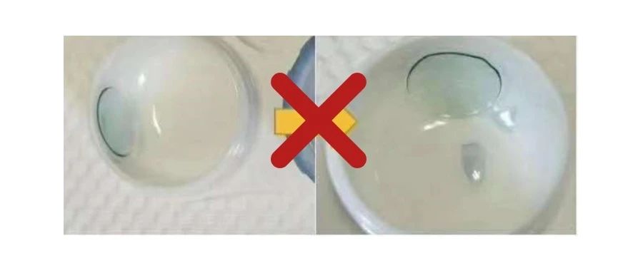 冬天戴角膜塑形镜旅行注意事项,角膜塑形镜超期使用