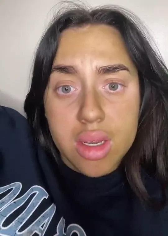 美国妹纸使用过期一年的美黑乳液，全身变绿，自嘲变成怪物史莱克