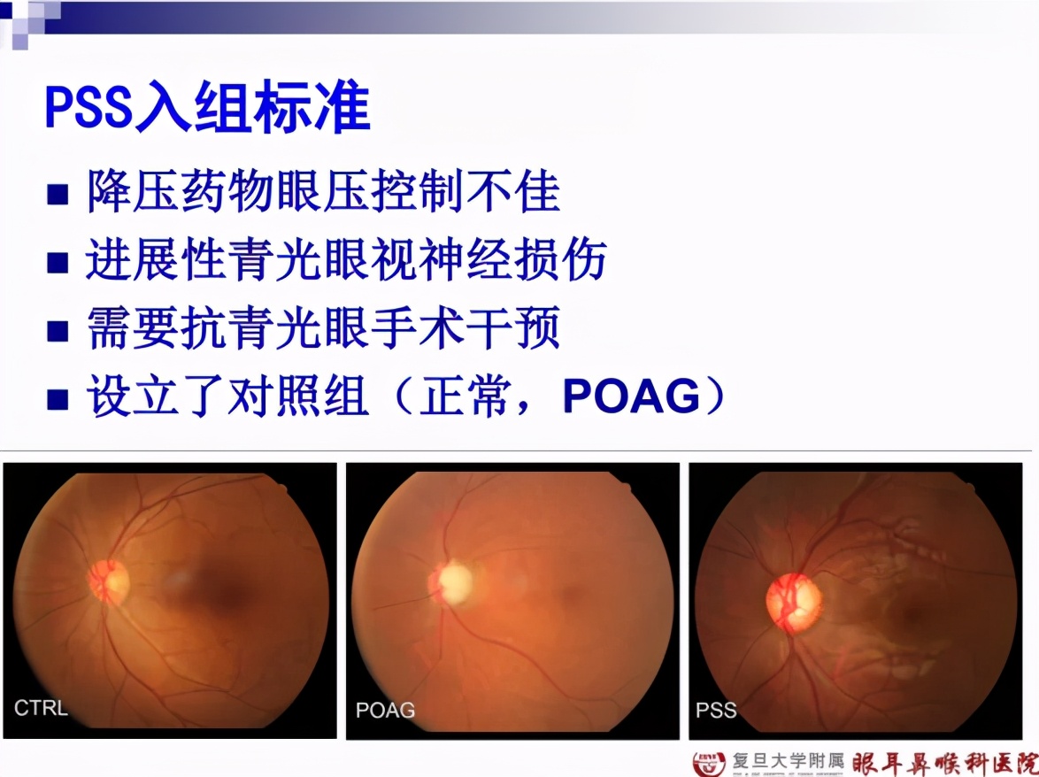 孙兴怀青睫综合症,孙兴怀谈ucp治疗青光眼