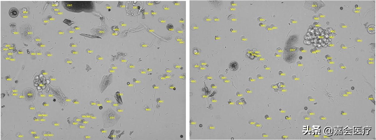 尿液突然变红、变绿?注意这些常见药会改变尿液颜色
