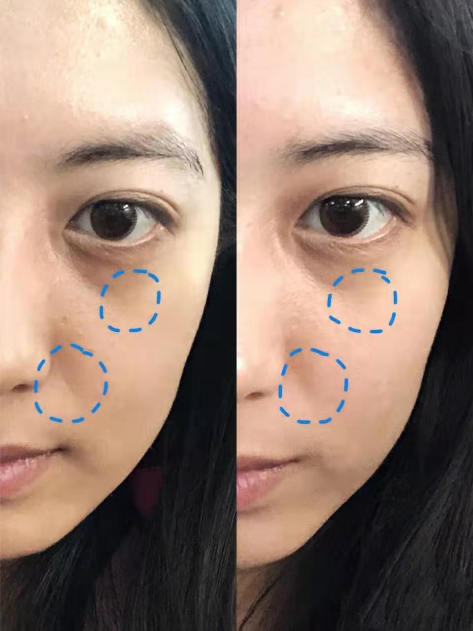 卸妆怎么才能卸干净呢,卸妆没卸干净怎么补救