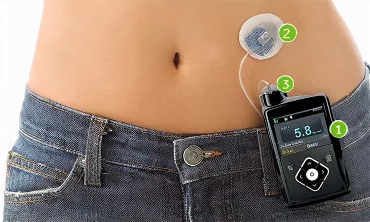 430亿美金并购案,美敦力收购