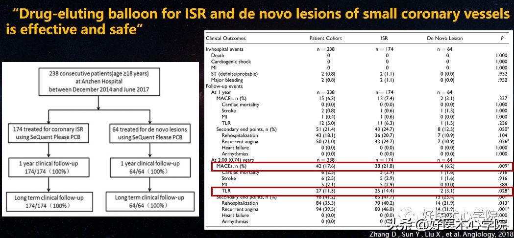 安贞医院冠心病介入治疗新技术,冠心病介入术