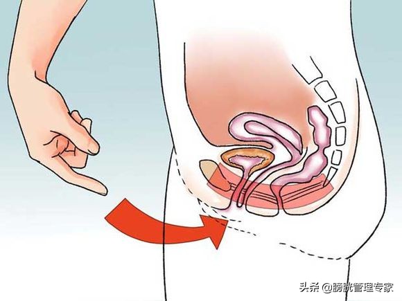 产后会尿失禁吗,产后尿失禁为什么