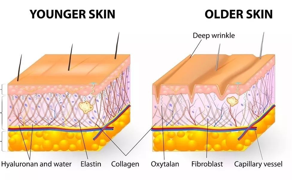 橘子皮怎么收缩毛孔,毛孔粗大橘子皮肤质还有救吗
