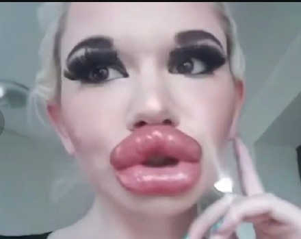 世界上最漂亮的嘴唇,世界嘴唇最厚的女人