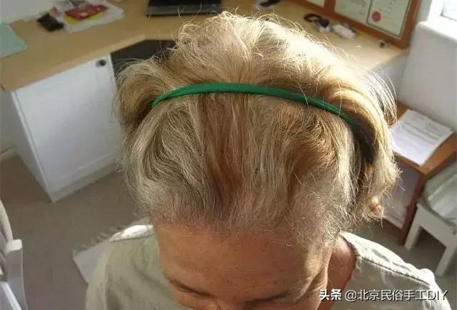 连体袜破洞修补方法慢动作,连体袜破洞怎么处理