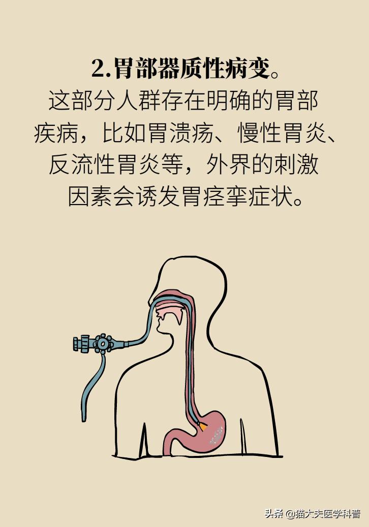 胃痉挛怎么能彻底治愈,胃痉挛怎么办快速缓解