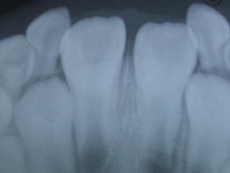 瀛欎开缁欏瀛愮湅鐨勭墮榻跨殑瑙嗛,瀛欎开鎹㈢墮