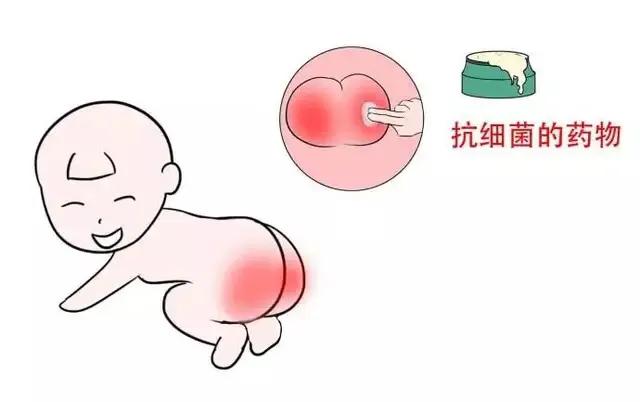 宝宝红屁股怎样护理,宝宝红屁股怎么护理最好
