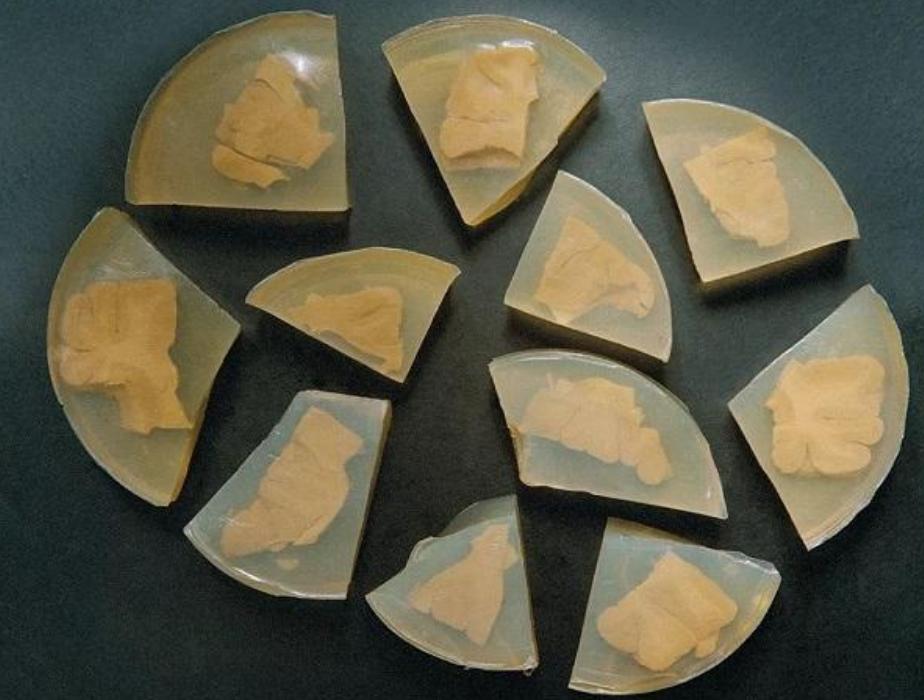 爱因斯坦死后的大脑被人偷走了吗,爱因斯坦死后大脑竟然被保留