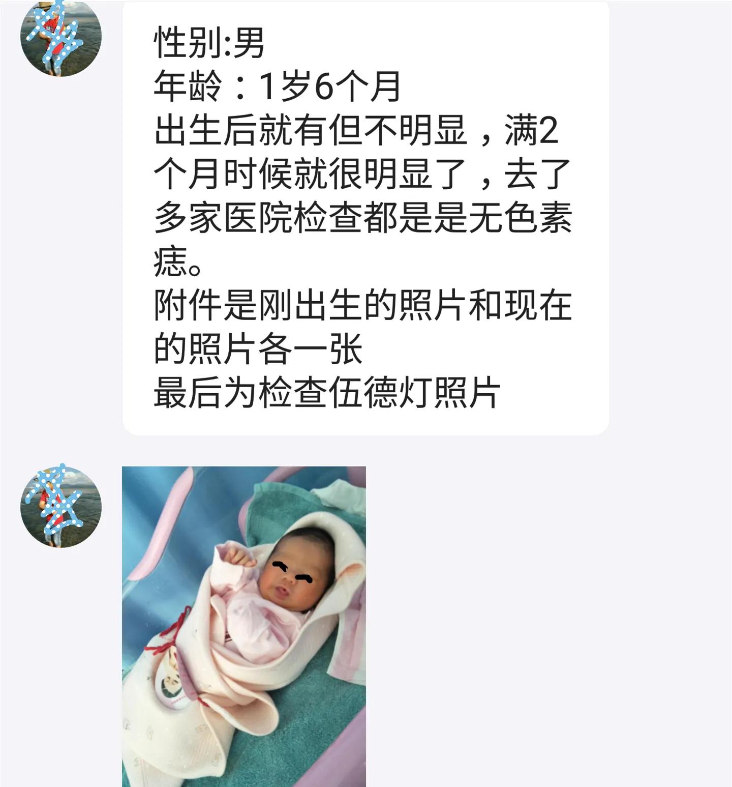 咨询故事：这个孩子额头的白斑是什么病？