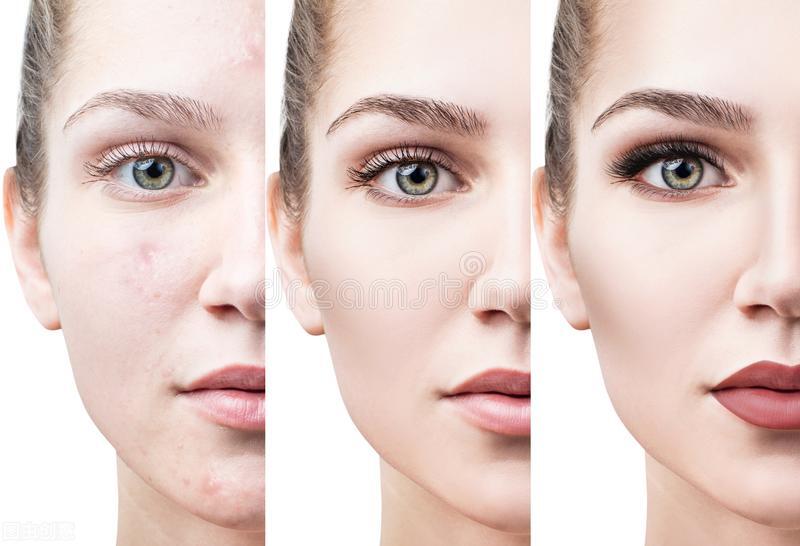 我又长痘了怎么回复,原本脸上没有痘突然脸上爆痘