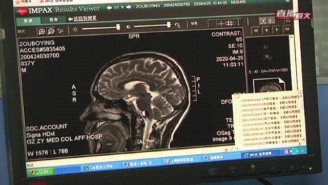 遵义世界首例换头手术,遵义第一工程