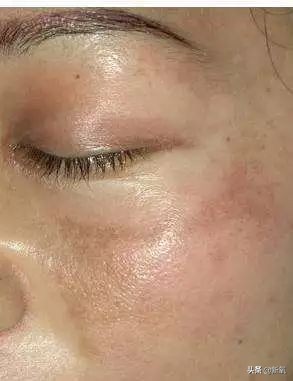 刘诗诗怀孕期间皮肤,刘诗诗怀孕秘闻