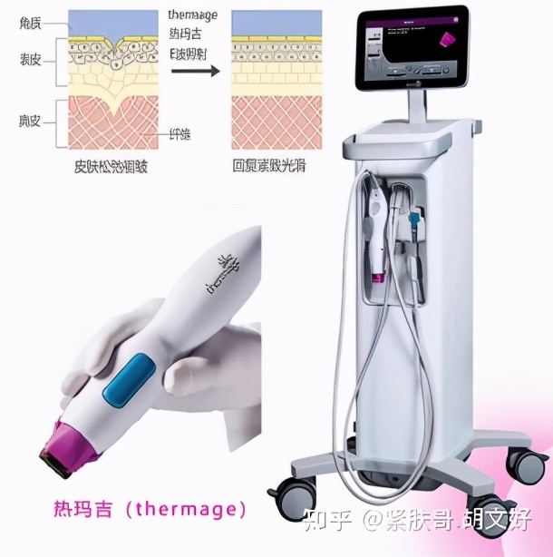 哪些人群不适合做热玛吉？
