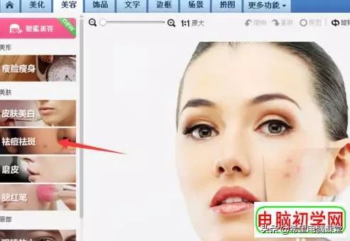 照片上痘痘怎么去除,怎么去除照片上的痘痘