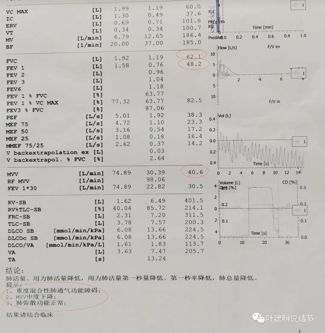 左肺癌手术半年右肺下角还有炎症,左下肺癌晚期
