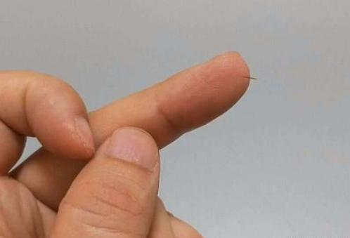 挑刺不用针的小窍门,怎么用大长针挑刺