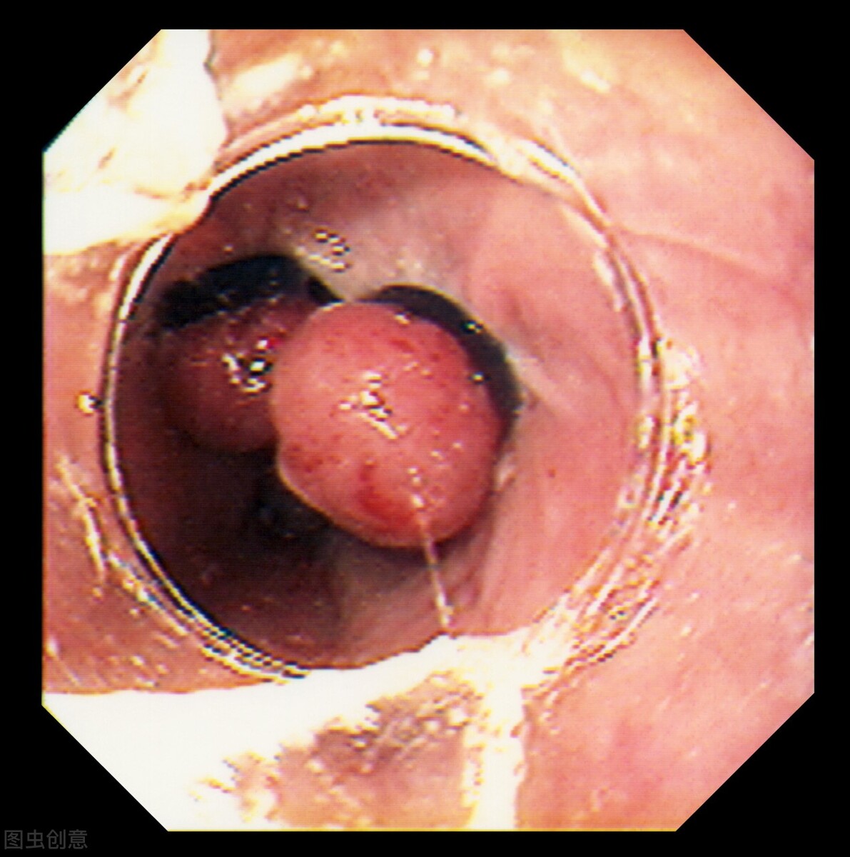 多喝烫水为啥会火,多喝烫水危害动画