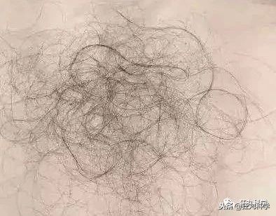 日本秃头猴子吃鱼10个月生发成功，脱发网友求购买链接