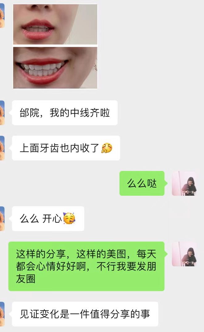 南京靠谱的牙齿矫正医院,南京省哪个医院牙齿矫正比较好